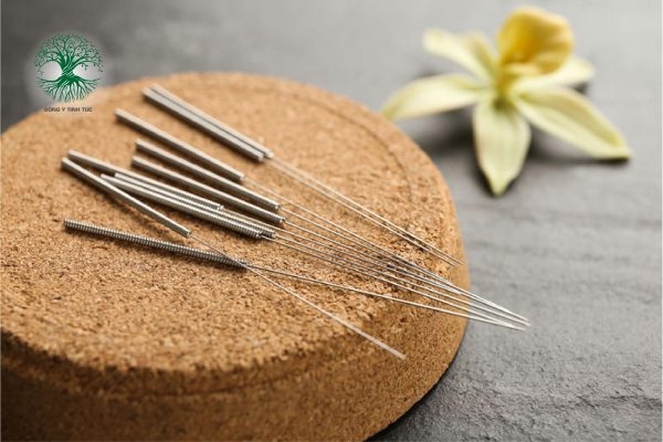 cham cuu chua mat ngu 01