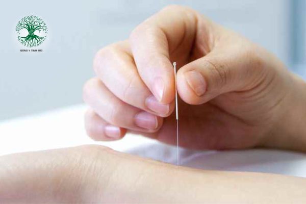 cham cuu chua mat ngu 02